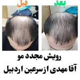 خرید تونیک تقویت کننده مو ۳۰۰ میل BIZ - فروشگاه زیبایی با بیتا